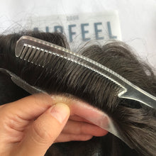 Load image into Gallery viewer, injected hair system natural hairline